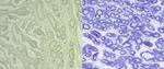 CD61 Antibody in Immunohistochemistry (Paraffin) (IHC (P))