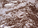 CD63 Antibody in Immunohistochemistry (Paraffin) (IHC (P))