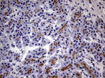 CD63 Antibody in Immunohistochemistry (Paraffin) (IHC (P))