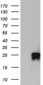 CD63 Antibody in Western Blot (WB)