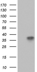 CD63 Antibody in Western Blot (WB)