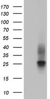 CD63 Antibody in Western Blot (WB)