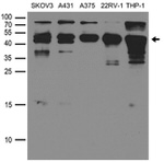 CD63 Antibody in Western Blot (WB)