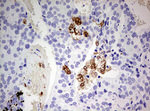 CD68 Antibody in Immunohistochemistry (Paraffin) (IHC (P))