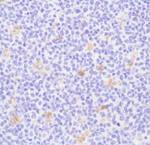 CD68 Antibody in Immunohistochemistry (Paraffin) (IHC (P))