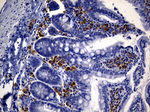 CD74 Antibody in Immunohistochemistry (Paraffin) (IHC (P))