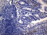 CD74 Antibody in Immunohistochemistry (Paraffin) (IHC (P))