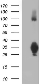 CD74 Antibody in Western Blot (WB)