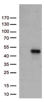 CD74 Antibody in Western Blot (WB)