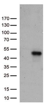 CD74 Antibody in Western Blot (WB)
