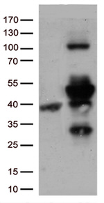 CD74 Antibody in Western Blot (WB)