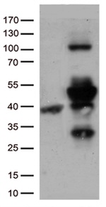 CD74 Antibody in Western Blot (WB)