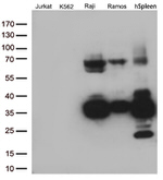 CD74 Antibody in Western Blot (WB)