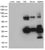 CD74 Antibody in Western Blot (WB)