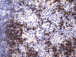 CD79A Antibody in Immunohistochemistry (Paraffin) (IHC (P))