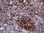 CD79A Antibody in Immunohistochemistry (Paraffin) (IHC (P))