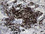 CD79B Antibody in Immunohistochemistry (Paraffin) (IHC (P))