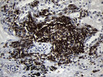 CD79B Antibody in Immunohistochemistry (Paraffin) (IHC (P))