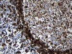 CD79B Antibody in Immunohistochemistry (Paraffin) (IHC (P))