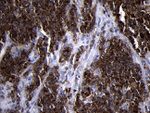 CD79B Antibody in Immunohistochemistry (Paraffin) (IHC (P))