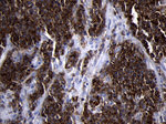 CD79B Antibody in Immunohistochemistry (Paraffin) (IHC (P))