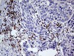 CD79B Antibody in Immunohistochemistry (Paraffin) (IHC (P))