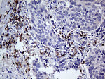 CD79B Antibody in Immunohistochemistry (Paraffin) (IHC (P))