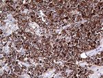 CD79B Antibody in Immunohistochemistry (Paraffin) (IHC (P))