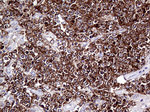 CD79B Antibody in Immunohistochemistry (Paraffin) (IHC (P))