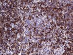 CD79B Antibody in Immunohistochemistry (Paraffin) (IHC (P))