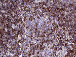 CD79B Antibody in Immunohistochemistry (Paraffin) (IHC (P))