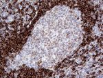 CD79B Antibody in Immunohistochemistry (Paraffin) (IHC (P))