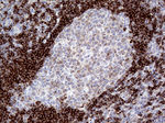 CD79B Antibody in Immunohistochemistry (Paraffin) (IHC (P))