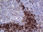 CD79B Antibody in Immunohistochemistry (Paraffin) (IHC (P))