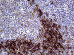 CD79B Antibody in Immunohistochemistry (Paraffin) (IHC (P))