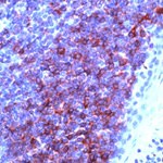 CD79a Antibody in Immunohistochemistry (IHC)