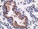 CD80 Antibody in Immunohistochemistry (Paraffin) (IHC (P))