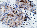 CD80 Antibody in Immunohistochemistry (Paraffin) (IHC (P))