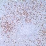 CD8 Antibody in Immunohistochemistry (IHC)