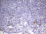 CD8A Antibody in Immunohistochemistry (Paraffin) (IHC (P))