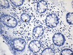 CD8A Antibody in Immunohistochemistry (Paraffin) (IHC (P))