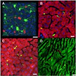 CD8a Antibody in Immunohistochemistry (IHC)
