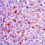 CD9 Antibody in Immunohistochemistry (IHC)