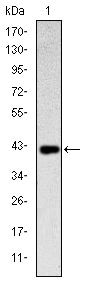 CD94 Monoclonal Antibody (1H1)