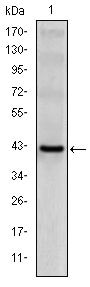 CD94 Monoclonal Antibody (3G2)