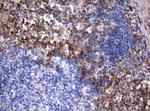 CD99 Antibody in Immunohistochemistry (Paraffin) (IHC (P))