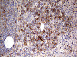 CD99 Antibody in Immunohistochemistry (Paraffin) (IHC (P))