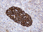 CD99 Antibody in Immunohistochemistry (Paraffin) (IHC (P))