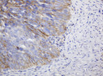 CD99 Antibody in Immunohistochemistry (Paraffin) (IHC (P))