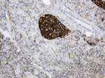 CD99 Antibody in Immunohistochemistry (Paraffin) (IHC (P))